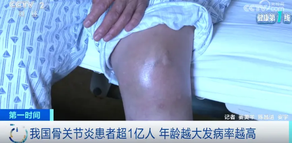 1-我国患者已超1亿人，被称为头号致残性疾病！最新提醒.png