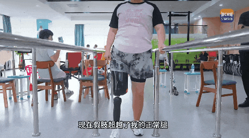 张女士正借助假肢进行行走训练